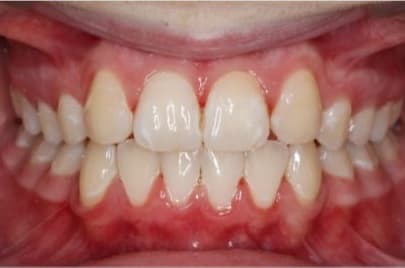 Case 1 after