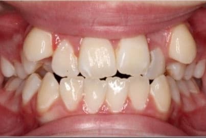 Case 1 before