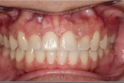 Case 10 after