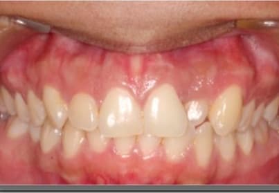 Case 10 before