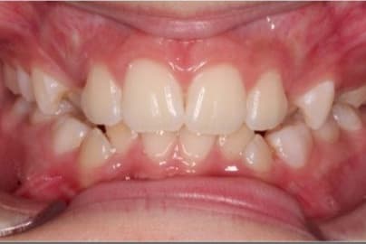Case 12 before