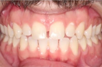 Case 13 before