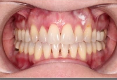 Case 15 after