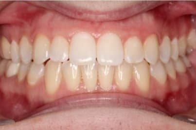 Case 16 after