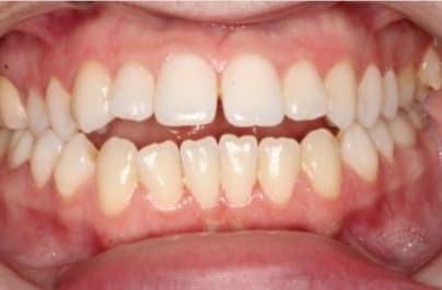 Case 16 before