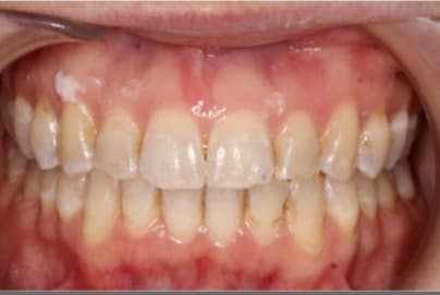 Case 2 after