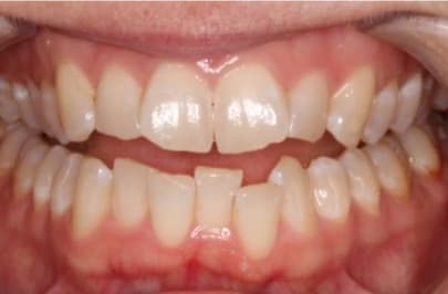 Case 2 before