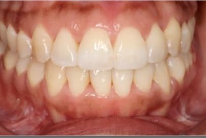 Case 4 after