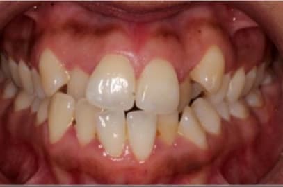 Case 4 before