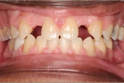Case 5 after