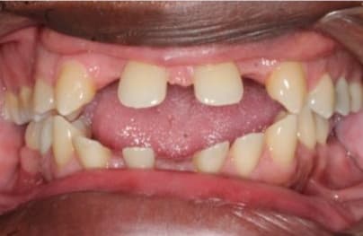 Case 5 before