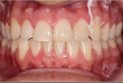 Case 6 after