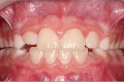 Case 7 after