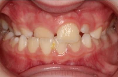 Case 7 before