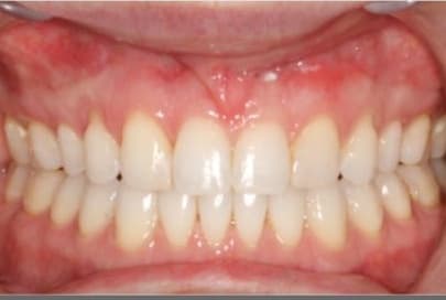 Case 8 after