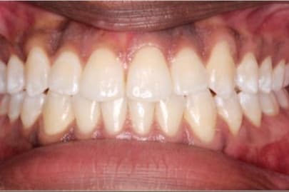 Case 9 after