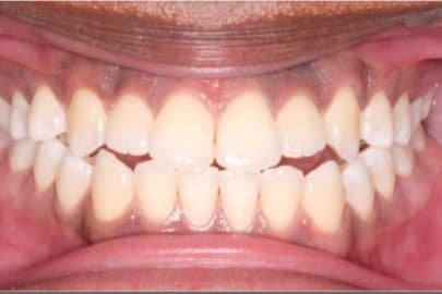 Case 9 before