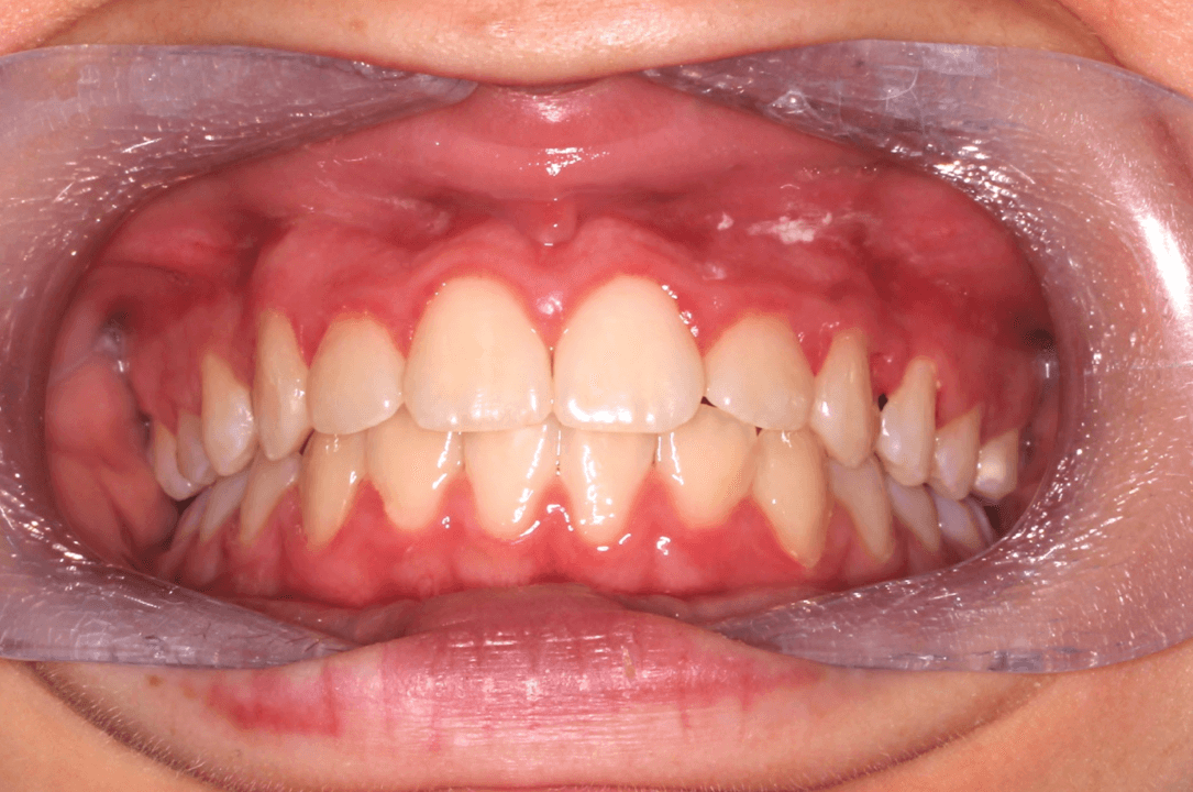Case 7 after