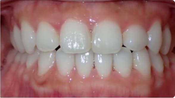Case 1 after