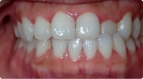 Case 1 before