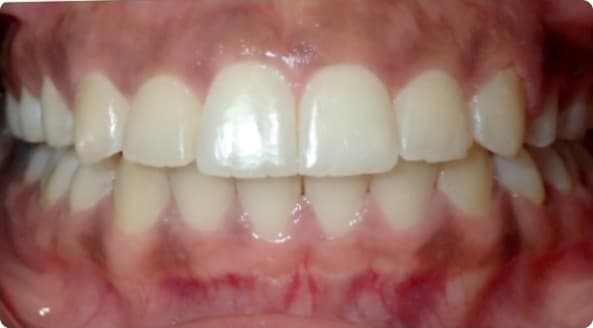 Case 10 after