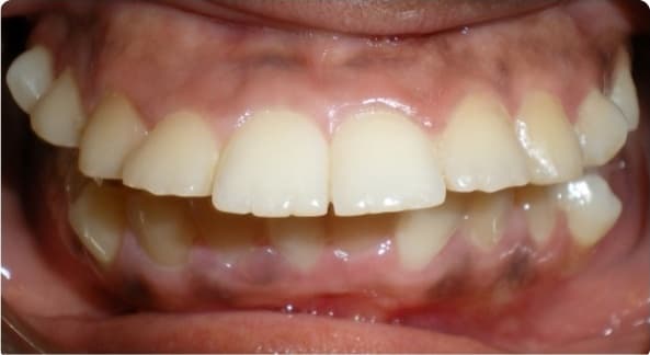 Case 10 before