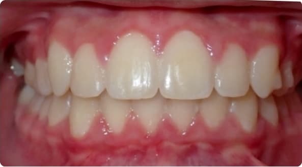 Case 12 after
