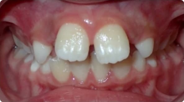 Case 12 before