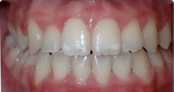 Case 15 after