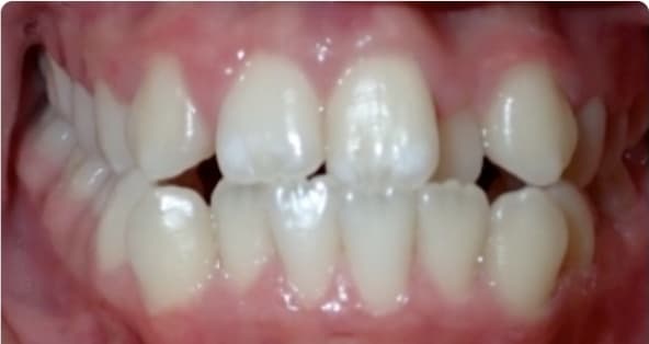 Case 15 before