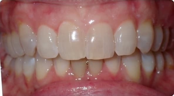 Case 16 after