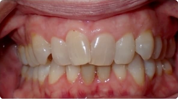 Case 16 before