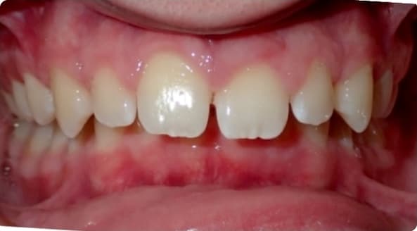 Case 17 before