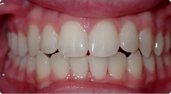 Case 18 after