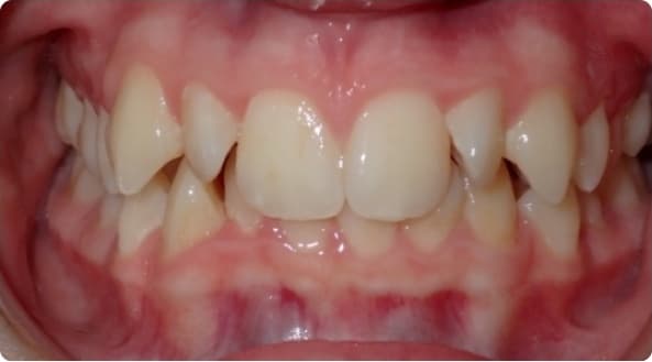 Case 18 before