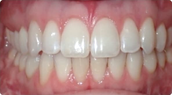 Case 19 after