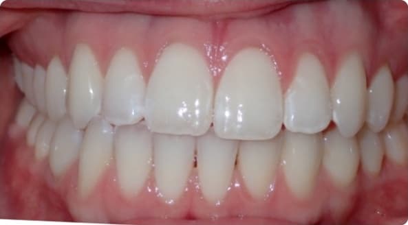 Case 19 before