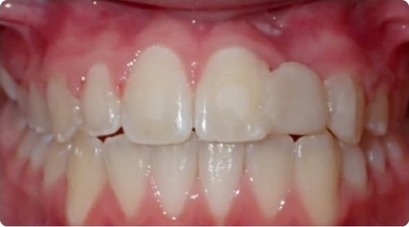 Case 2 after