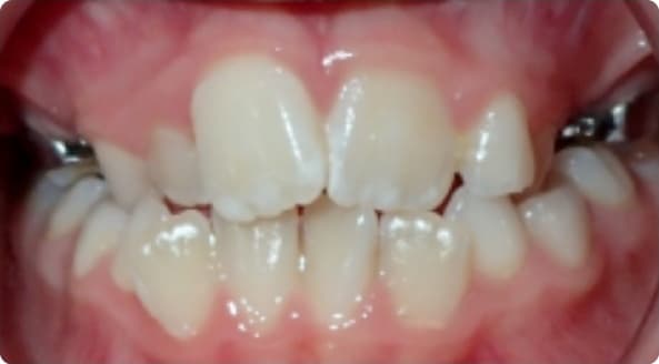 Case 2 before