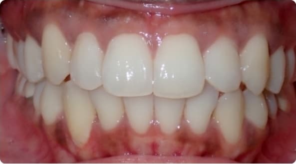 Case 20 after