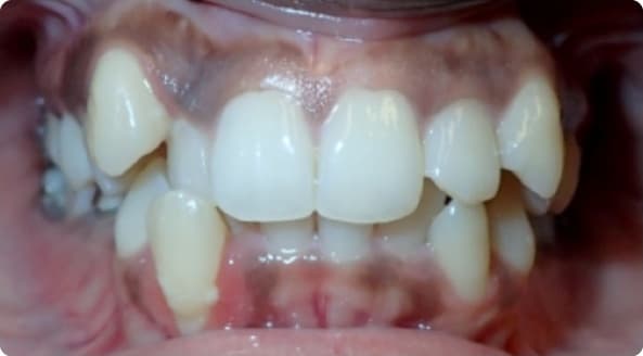 Case 20 before