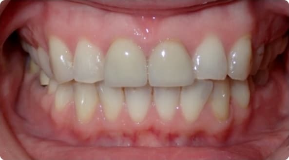 Case 21 before