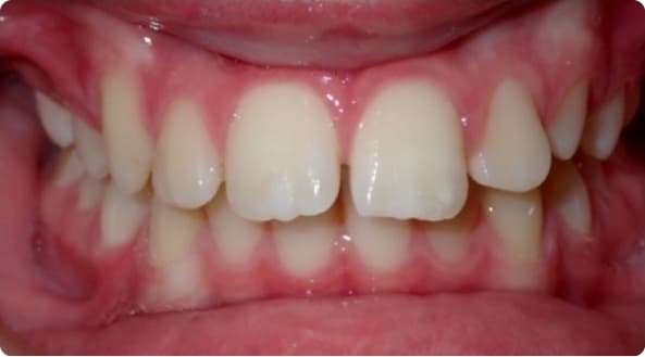 Case 22 before