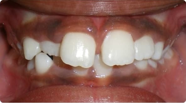 Case 23 before