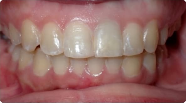 Case 24 after