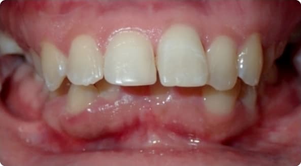 Case 24 before