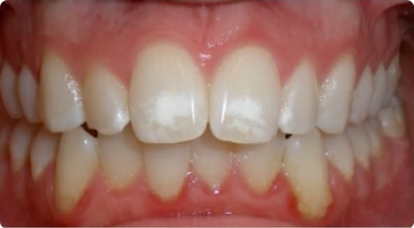 Case 25 before