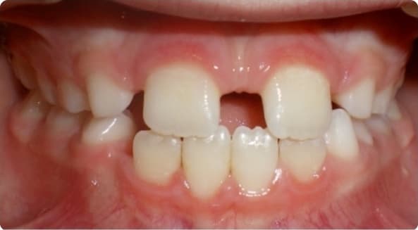 Case 26 before