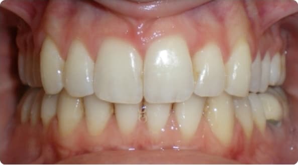 Case 27 after