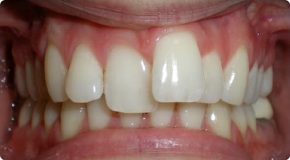 Case 27 before